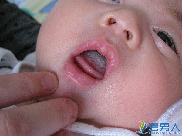 >为什么宝宝舌头上有一层厚厚的舌苔是怎么回事呢