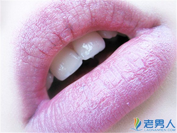 >经常使用唇膏可能患炎症 引起唇炎的原因