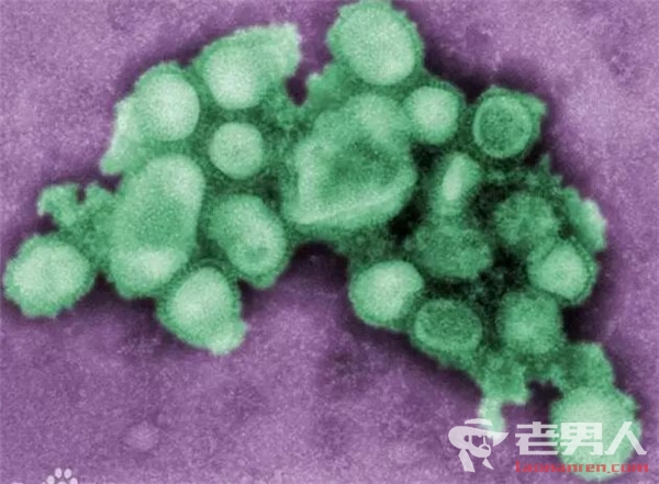 >流感病毒悄然转变为甲型H1N1 预防流感应该注意哪些