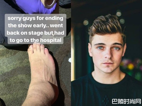 Martin Garrix摔下DJ台送医急救 脚踝摔伤可能影响表演