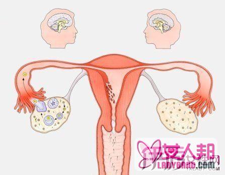 >卵巢不好有什么症状 对症调理卵巢功能