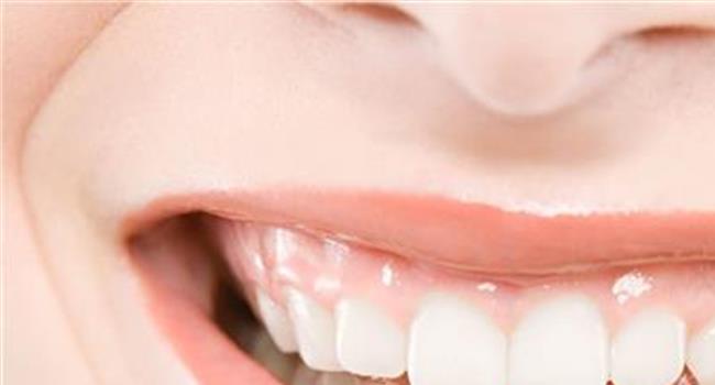 【怎么让牙齿美白】牙齿美白的几种方法
