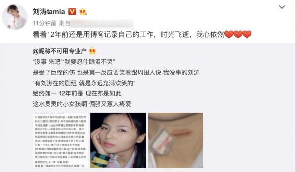 刘涛分享博客旧文 惊险动作戏留“割喉”旧伤