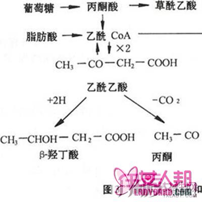 为什么酮症酸中毒会有急腹症？   酮症酸中毒的治疗方法