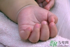 新生儿手指甲什么时候剪?新生儿手指甲怎么剪?
