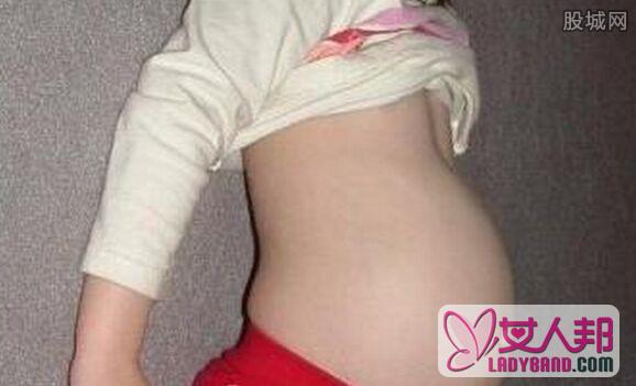 腹中藏婴儿15年 少女体内竟存“寄生胎”好吓人