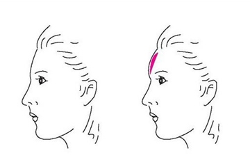 >额头化妆用什么化妆品 额头怎么变饱满漂亮