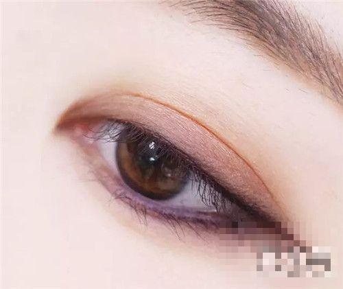 美瞳线的危害有哪些 美瞳线的危害影响介绍