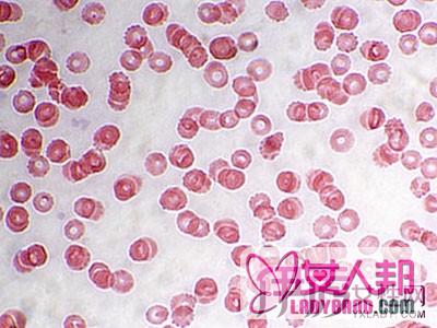 >白细胞和红细胞都偏低是咋回事呢 白细胞低的3个原因