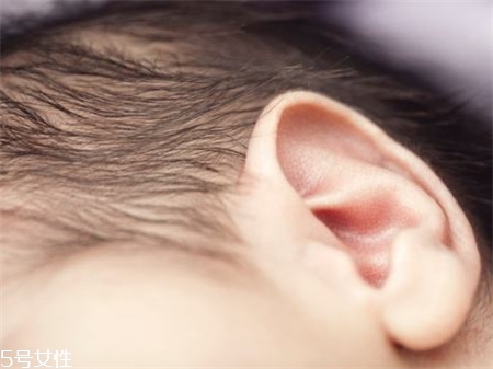 >新生儿耳朵上有黑毛怎么回事 注意两种情况