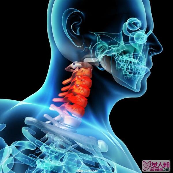 盘点颈椎病发作时的4个症状表现