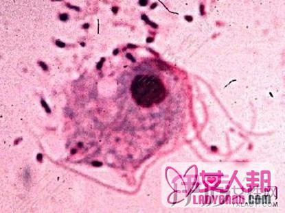 引起阴道霉菌感染的原因是什么？ 我们该怎么避免感染！