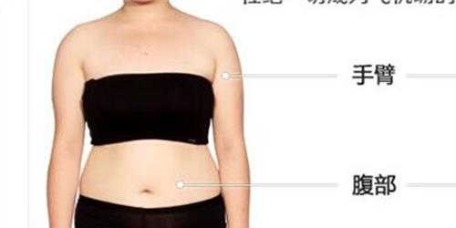 吸脂减肥前后对比图