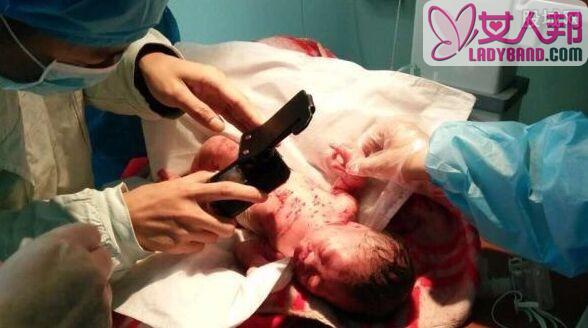 15岁女孩产子用竹签将其戳伤 婴儿全身伤抢救无效死亡