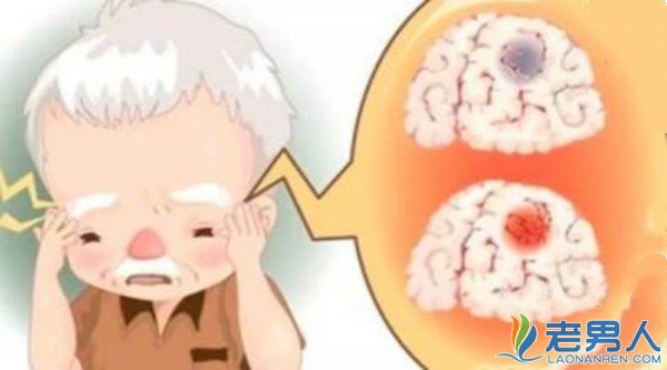 >老人脑梗死有哪些症状及最佳治疗方法