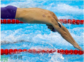 >里约奥运会拔罐火了 拔罐多久后可以游泳？
