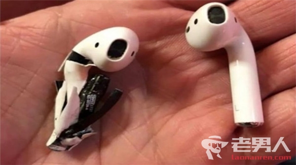 >苹果AirPods耳机突然冒烟 美国一男子耳朵险被烧伤