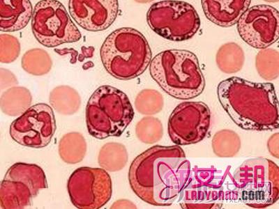 慢性粒细胞白血病能活多久 该病的临床分期和三大治疗方案