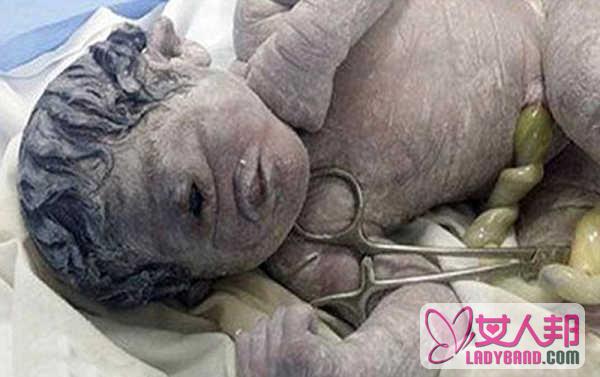 >【埃及婴儿一只眼睛】_埃及新生婴儿只有一只眼睛 畸形长相前所未见