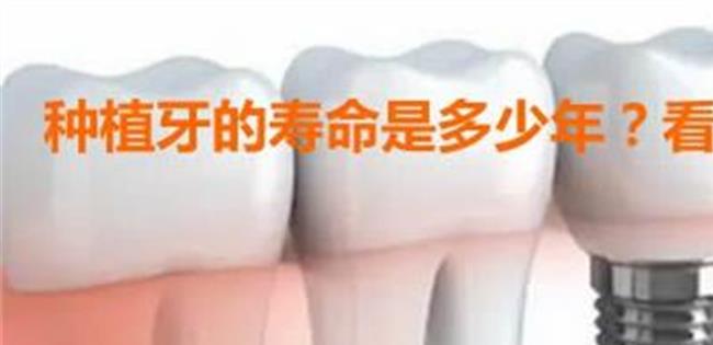 【种牙的副作用】种牙的发展历程
