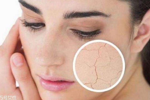 干性皮肤有几种？8种干皮类型的护肤策略