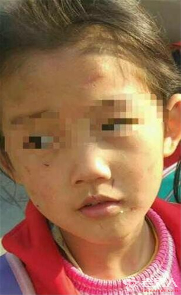 6岁女童遭虐待满身伤痕 背后真相看哭网友