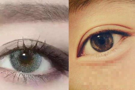 瞳孔的颜色多样 皆因虹膜的色素