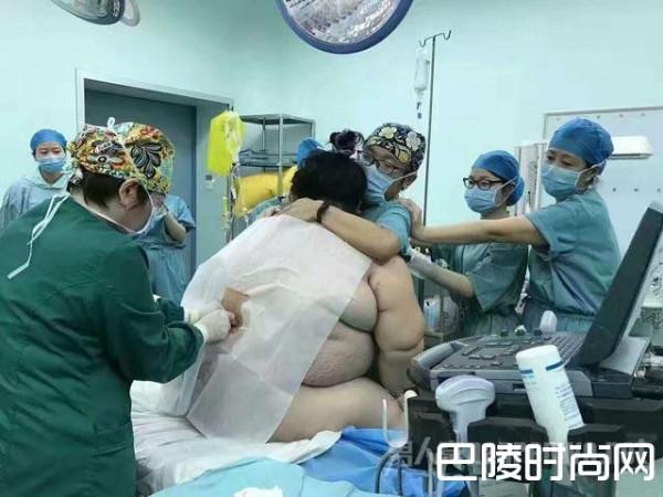 280斤孕妇临盆 16名医务人员为其接生