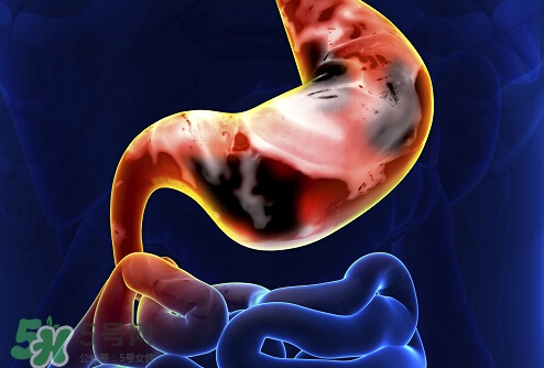 肠胃炎是怎么引起的？肠胃炎的症状及治疗