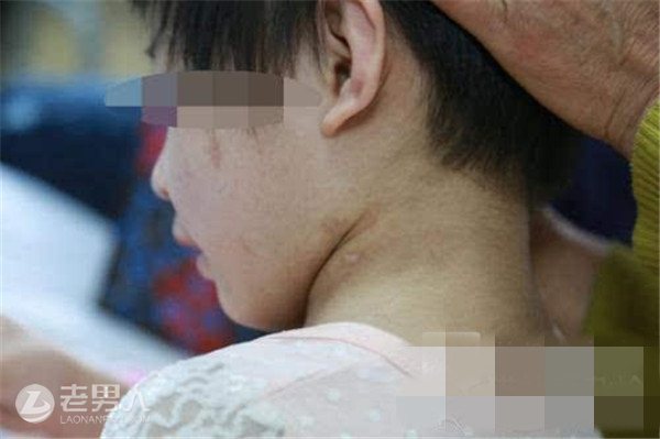 9岁女童遭哥哥虐待 残忍施暴致其多处骨折