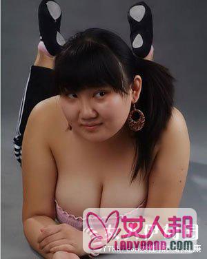 巨乳症的诊断依据