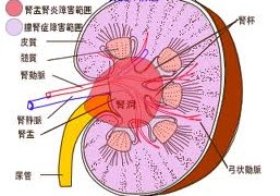 引发肾盂肾炎原因