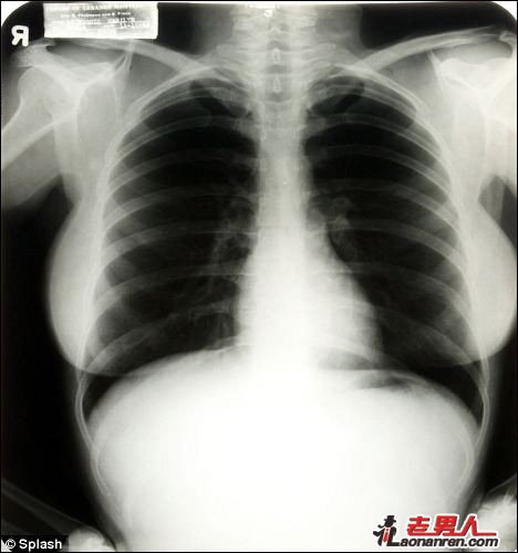 梦露胸部X光片清晰照片将拍卖【图】