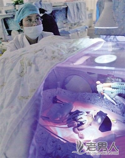 >“筷子宝宝”在出生19天后 因肺部感染抢救无效去世（图）