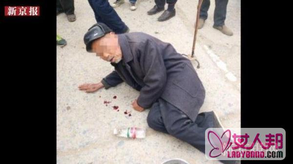 80岁老人街边行乞吐血 吐的实为染色剂
