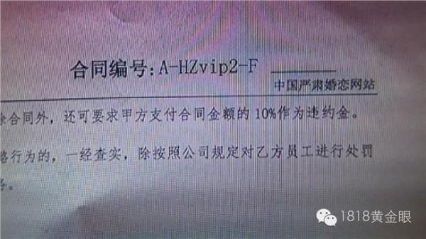 >特纳综合征鉴别诊断 特纳综合征需与哪些疾病鉴别?