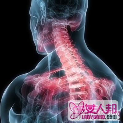 脊柱相关疾病示意图展示 了解脊柱相关疾病的病因