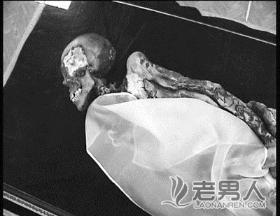 2500年前古尸冰雪公主死因查明：患乳腺癌吸食大麻过量（图）