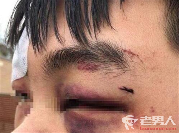 中国留学生在澳洲遭围殴 当地团伙多次骚扰中国留学生