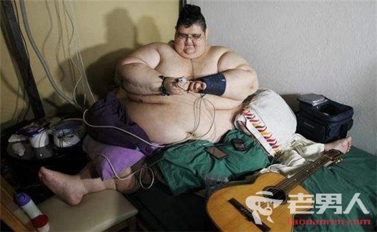 世界上最重的人胡安·佩德罗将去除60斤皮肤