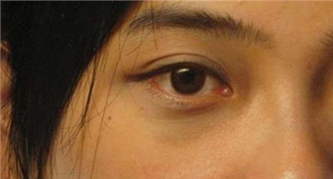 【你的眼睛里有璀璨星光】爱护你的眼睛有些损伤本可避免