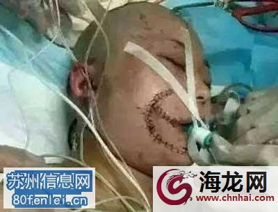 赵倩伊图片 被老虎咬伤的女人赵倩照片近况 北京被老虎咬伤女子已出院