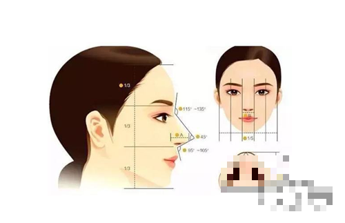 >线雕隆鼻能维持多久 线雕隆鼻有什么危害