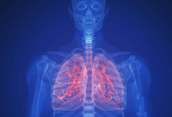 >肺部感染的症状_肺部感染是怎么引起的_肺部感染怎样治疗？推荐分类