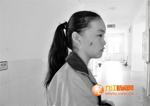 范镇求学 瑞昌范镇中学遭飞虫袭击 几十名学生被“咬”进医院