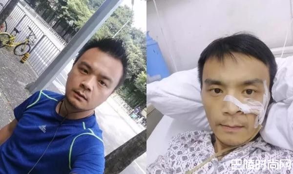 刘凌峰37岁广告人胃癌末期 腹部积水继续跑业务