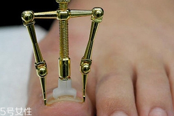 指甲矫正器怎么用 指甲矫正器的正确用法
