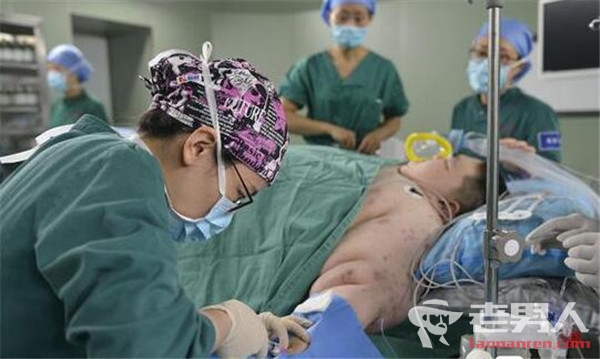 >首胖减重切8成胃 手术床和器械均量身打造