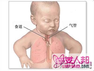 解答食道癌能治愈吗 三种治疗方法为你带来希望