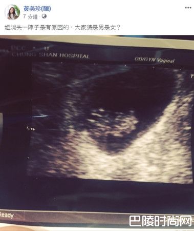 36岁黄美珍怀孕了 老公爆B超照报喜